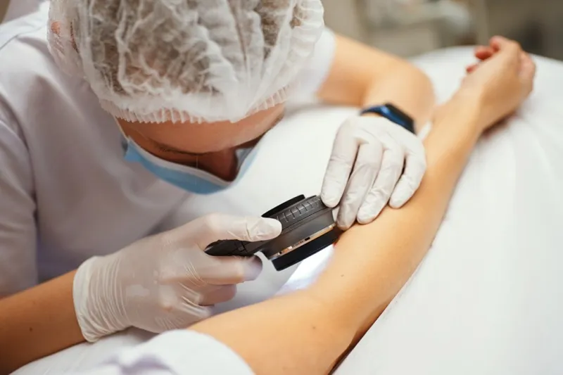Czym jest dermatoskop cyfrowy?